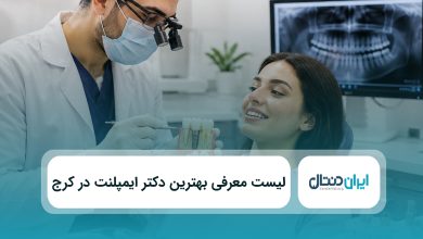 بهترین دکتر ایمپلنت در کرج