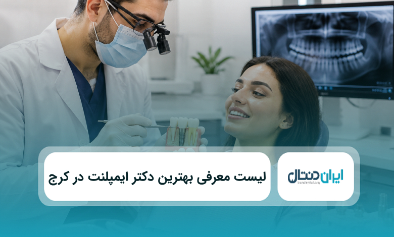 بهترین دکتر ایمپلنت در کرج