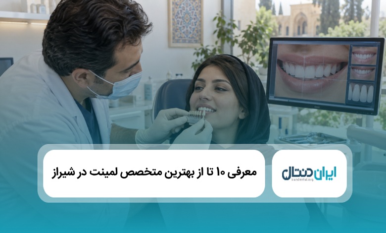 بهترین متخصص لمینت در شیراز
